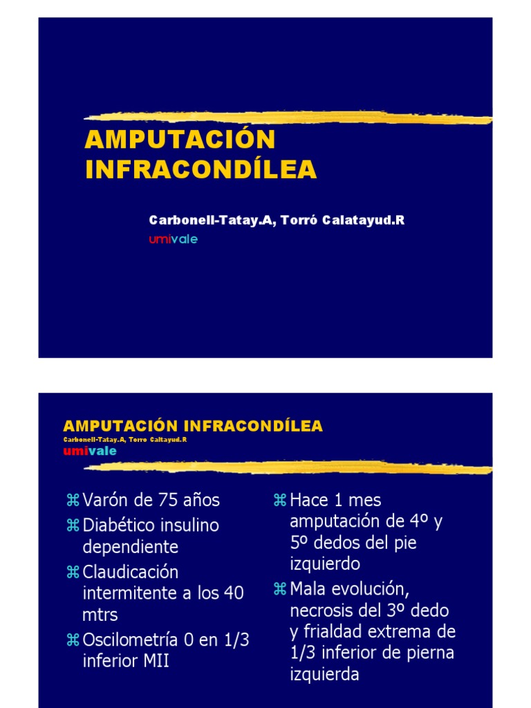 Detallada descripción de una amputación infracondílea para tratar