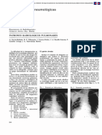 Actualizaciones Neumológicas: Patrones Radiológicos Pulmonares