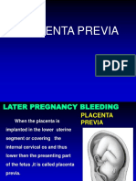 Placenta Previa and Placental Abruption