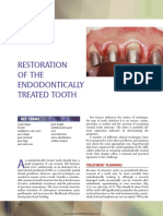 12 RESTORATION OF THE ENDODONTICALLY TREATED TOOTHmic PDF