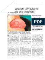 Oral Ulceration: GP Guide To Diagnosis and Treatment: Stephen Flint Ma, PHD, MB BS, BDS, FDSRCS, Ffdrcsi, Ficd