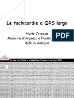 5-Tachicardie QRS Largo PDF