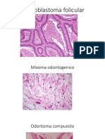 tumores odontogenicos