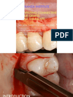 Harvesting Connective Tissue Grafts from the Palate