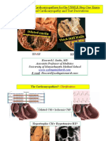 Dilated Cardiomyopathy and Test Derivatives Explained