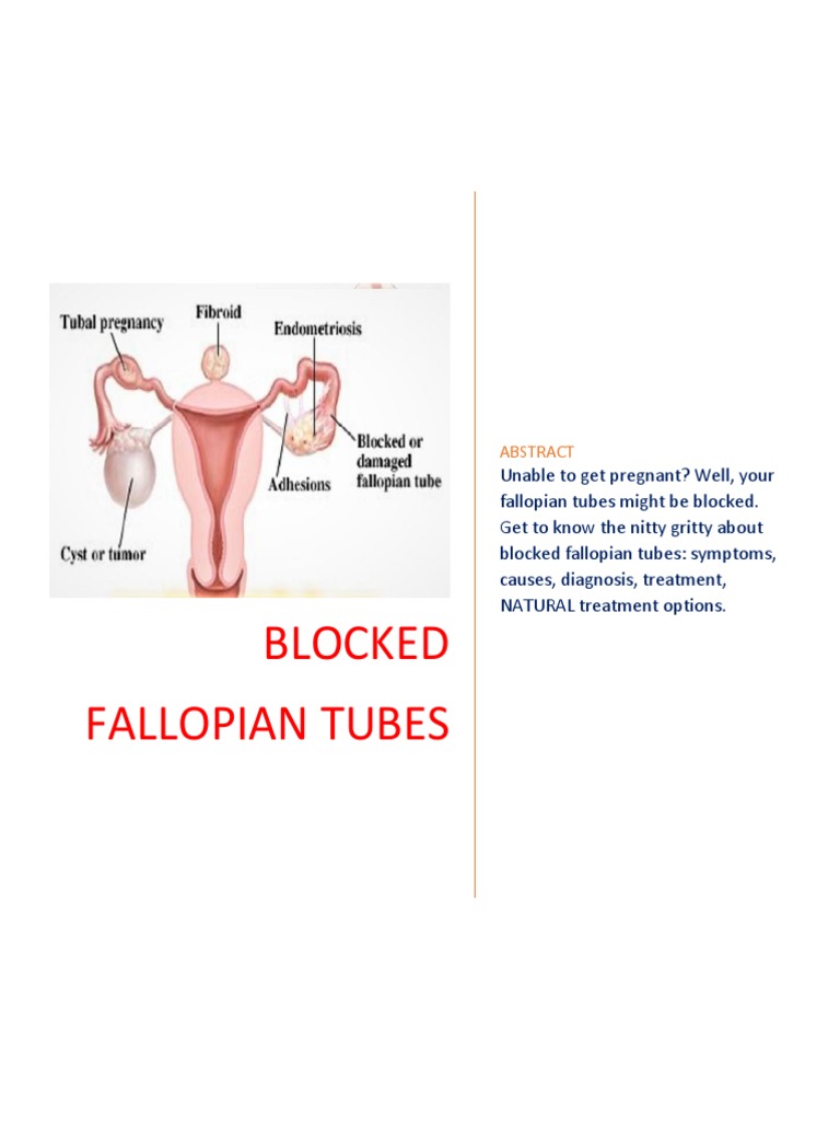 Blocked Fallopian Tubes | Mammal Female Reproductive System | Clinical ...