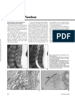 On The Viewbox: Dermoid Cyst in The Lumbosacral Region: Radiographic Findings