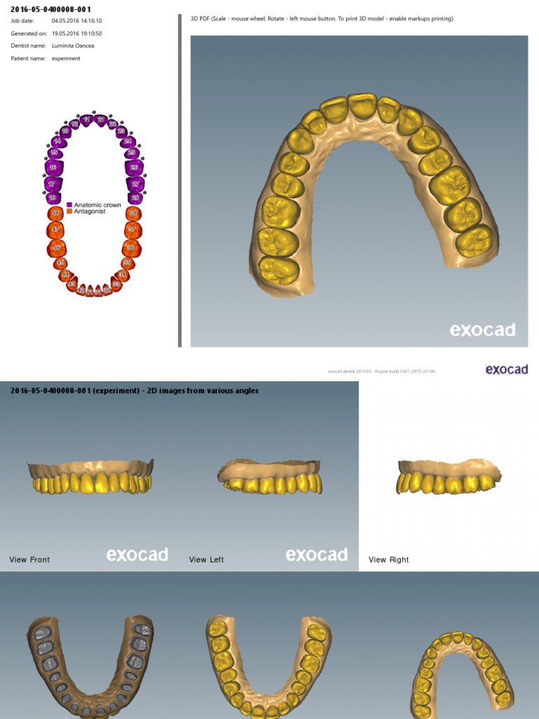 2016-05-04 - 00008-001-Model Initial | PDF | Dentistry | Mouth