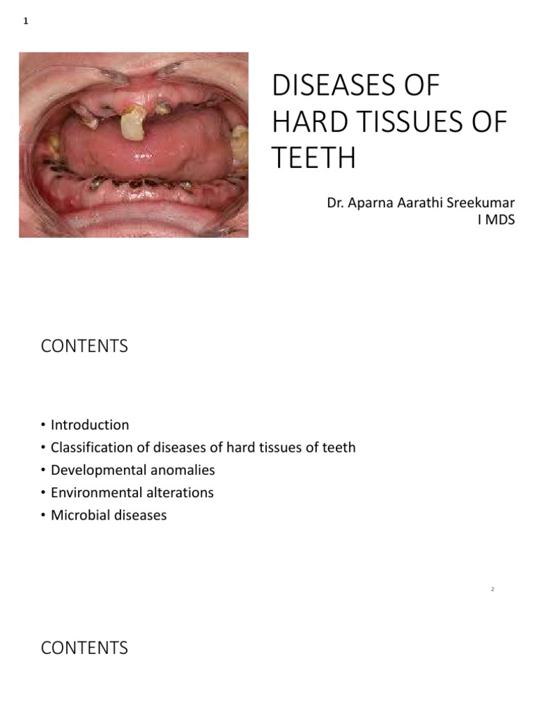 Diseases of Hard Tissues of Teeth PDF | PDF | Tooth Enamel | Tooth
