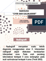 Liver Dan Gallbladder