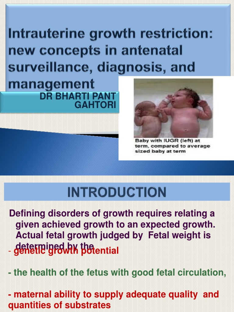 Fetal Growth Restriction Fetus Prenatal Development