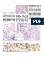 226 Tumours of Uncertain Differentiation