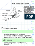 SD de L Tunel