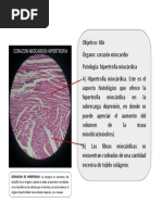 Vitropresión y diascopia en dermatología | PDF | Especialidades Medicas ...