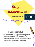 HYDROCEPHALUS