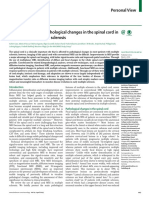 MRI Monitoring of Pathological Changes in The Spinal Cord in Patients With Multiple Sclerosis