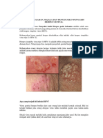 Cara Penularan dan pencegahan PENYAKIT HERPES.docx