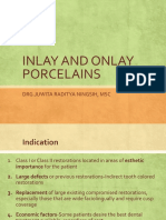 Inlay and Onlay Porcelaine