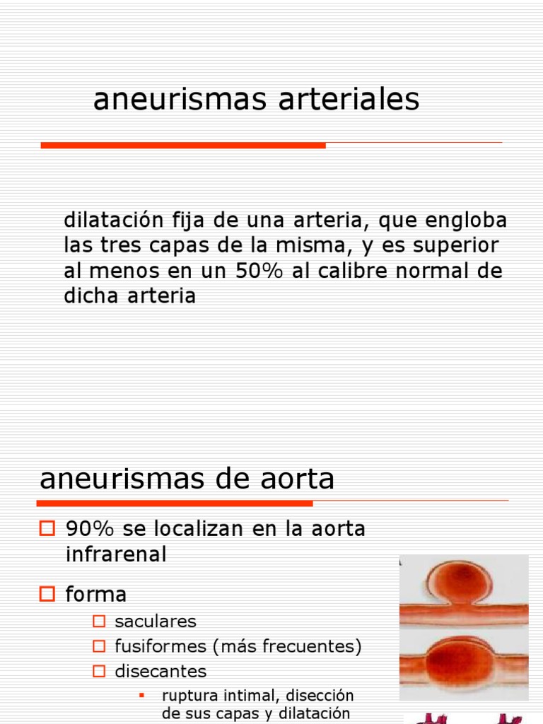 aneurismas arteriales | Especialidades Medicas | Medicina CLINICA