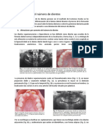 Alteraciones Oclusion