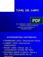 Tunel_del_carpo.pps