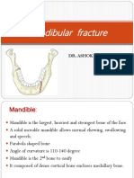 Mandibular Fracture: Dr. Ashok Kumar K.R