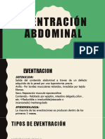 Eventracion Abdominal