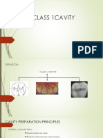 Class 1cavity