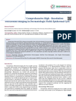 Usefulness of Comprehensive High - Resolution Ultrasound Imaging in Dermatologic Field: Epidermal Cyst