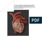 Heart Pathologies Design