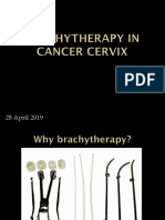 Brachytherapy in Cancer Cervix