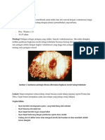 117751794-OSTEOID-OSTEOMA.docx