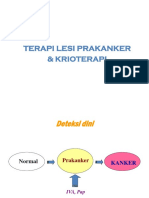 Terapi Lesi Prakanker.pptx
