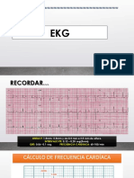 Ekg Patologico - Ejemplos