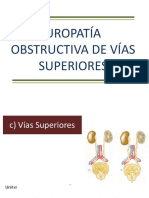 Uropatia Obstructiva Vias Superiores