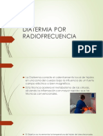 Radiofrecuencia