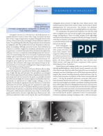 ADK Pancreatico Metastasico en Masa Pelvica Grande