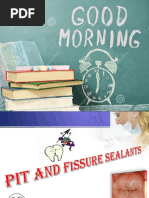 Pit and Fissure Sealants