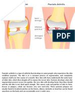 Psoriaticarthritisinvictoria