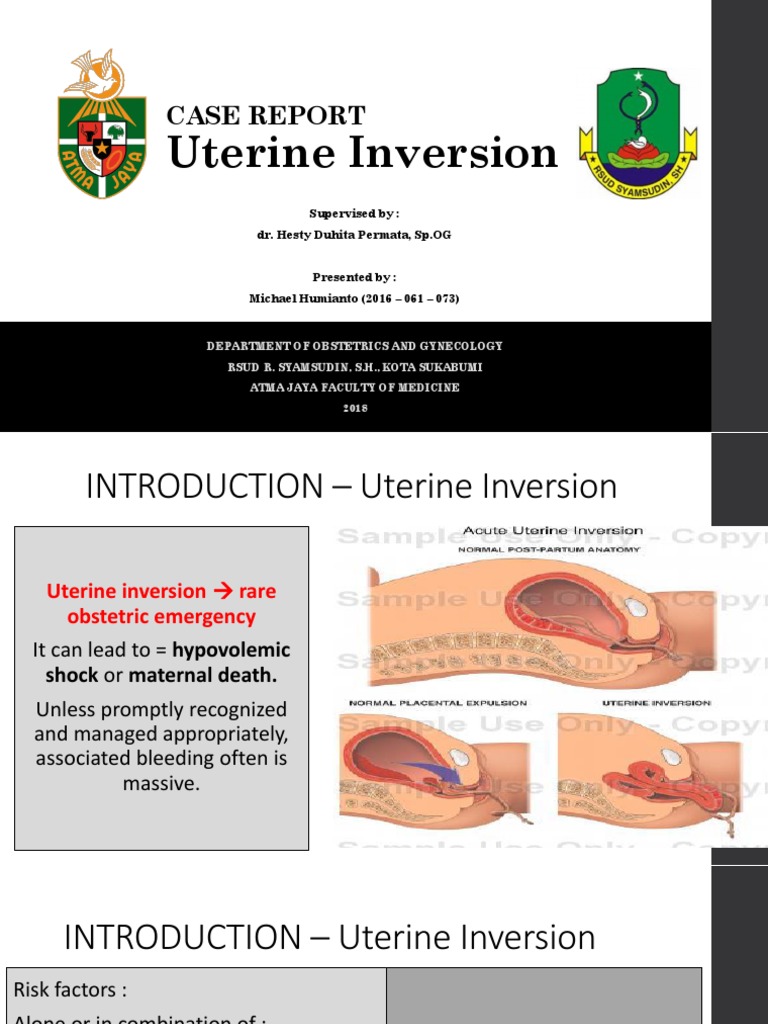 Uterine Inversion Case Report | PDF | Uterus | Postpartum Period