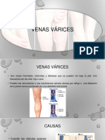 Venas Varices