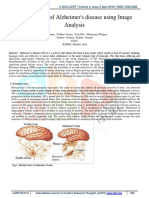 Identification of Alzheimer's Disease Using Image Analysis