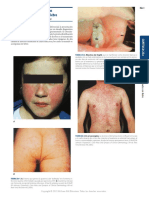 Part02-Secc02-25e Atlas de Exantemas Relacionados Con Fiebre