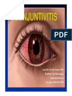 CONJUNTIVITIS