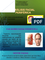 Parálisis facial periférica