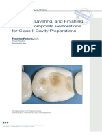 Adhesion, Layering, and Finishing of Resin Composite Restorations For Class II Cavity Preparations