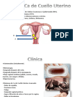 CA de Cuello Uterino 1