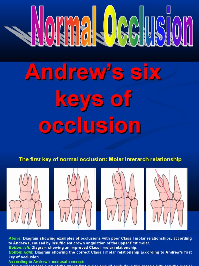 Andrews' Six Keys of Occlusion Explained | PDF | Tooth | Orthodontics