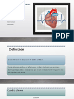 Arritmias Cardiacas