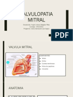 Valvulopatia Mitral